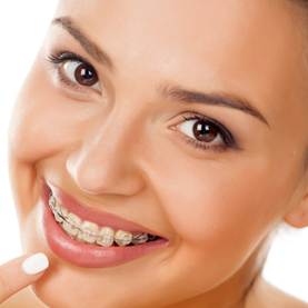 Tratamientos de ortodoncia para adultos